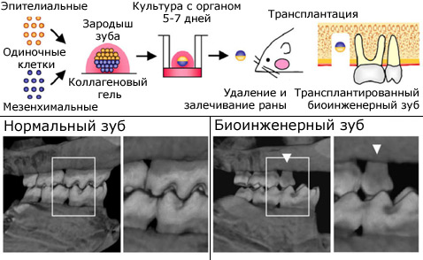 Зародыш биоинженерного зуба